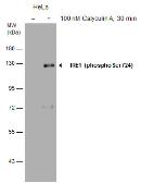 Anti-IRE1 alpha (phospho Ser724) antibody used in Western Blot (WB). GTX130378